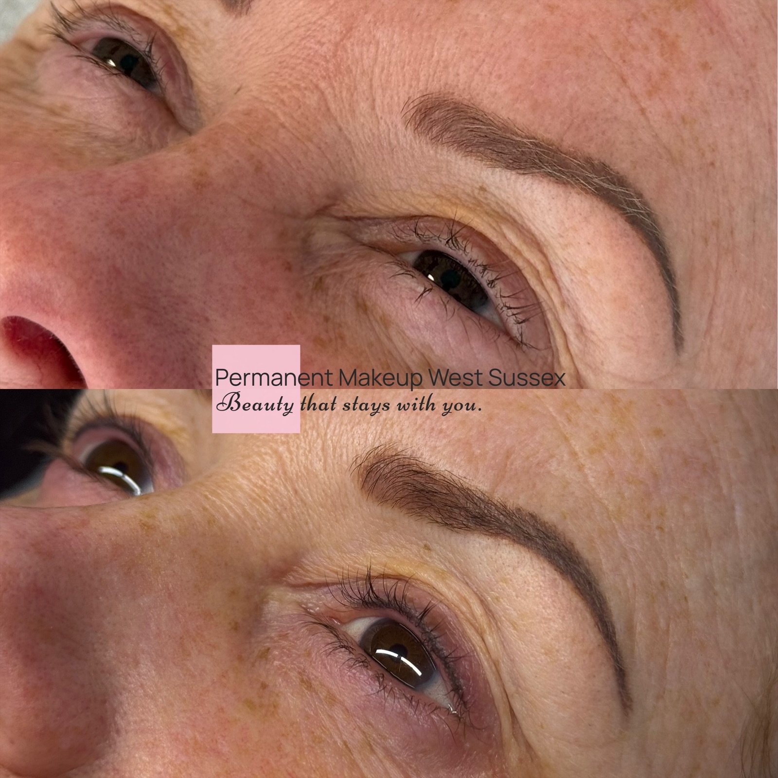 Brow restoration results — thin eyebrows before and after, healed and fuller
